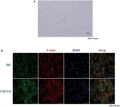 Cadmium Toxicity on Chondrocytes and the Palliative Effects of 1α, 25-Dihydroxy Vitamin D3 in White Leghorns Chicken's Embryo